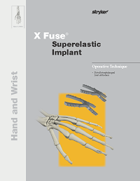X_fuse_implant