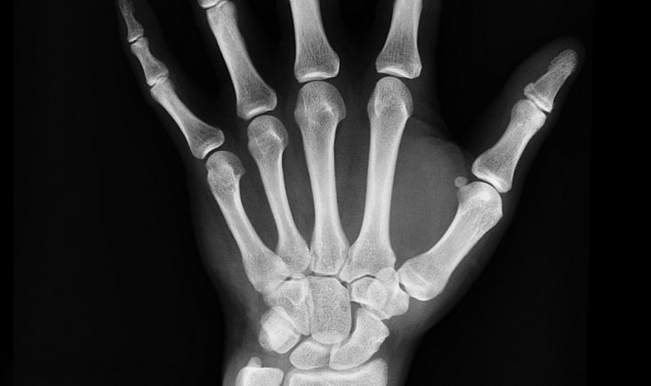 Chirugie orthopédique main, genou, hanche, épaule à Rennes